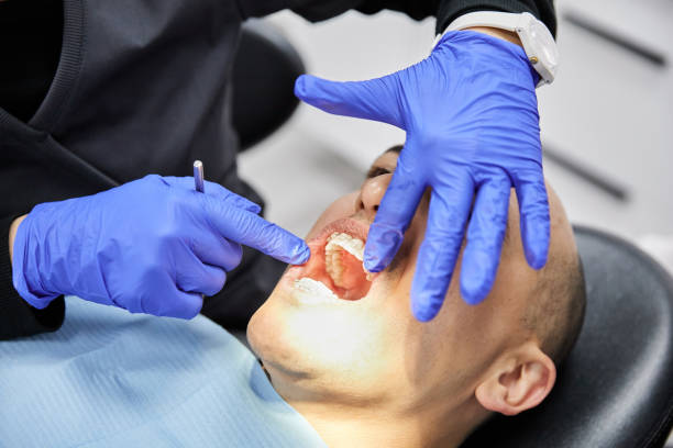 Best Emergency Dental Care for Broken or Chipped Teeth in Greenacres, CA